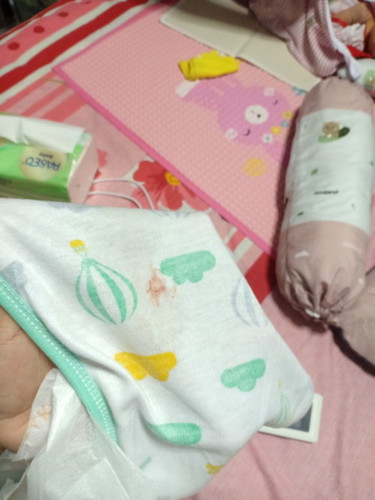 Tolong bantu jawab Kenapa pipis nya keluar darah atau ga cocok asi di mix sufor ya bunda bunda?