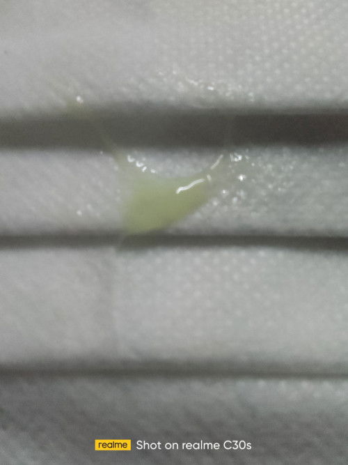 ตอนนี้ 36สัปดากับ6วันแล้วอายุครร