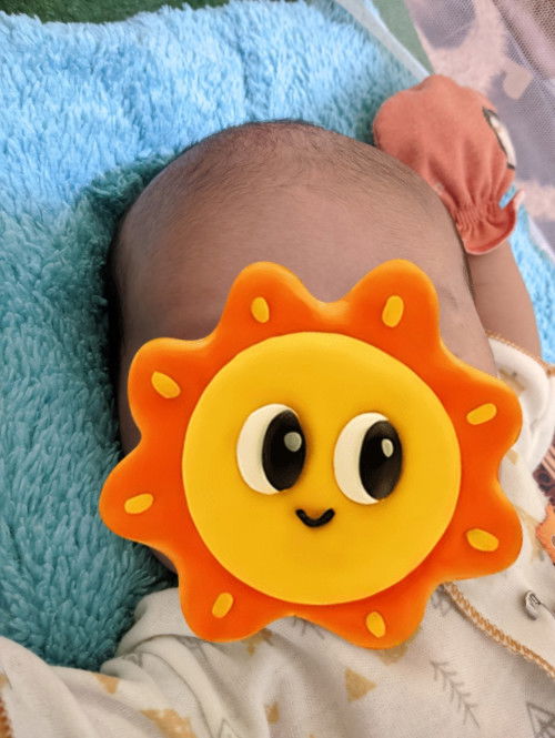 Ubun ubun bayi nonjol