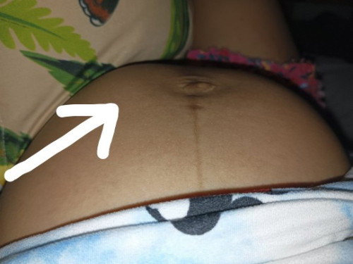 31 weeks preggy