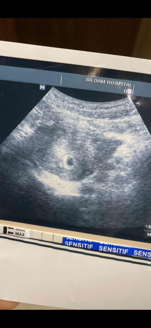 Tp sblm haid berbuah manis