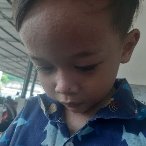 ruam pada kulit wajah dan badan