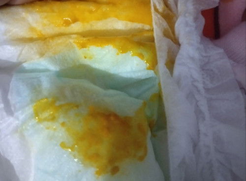 sorry gmbr kotor 😅 mommies sya mau bertnya bah.. najis bayi berusia 2minggu tpi ada lendiran,is it