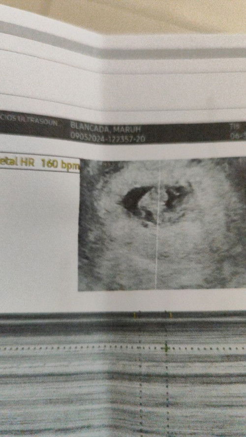 This might help other mommies.