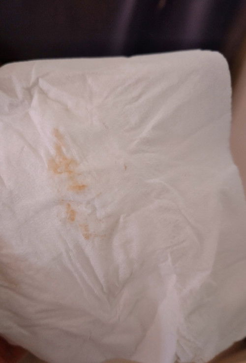 Flek dan keluar cairan