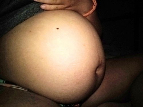 แม่ๆเป็นกรดไหลย้อนไหมคะทานยาตัวไหนได้บ้างคะ