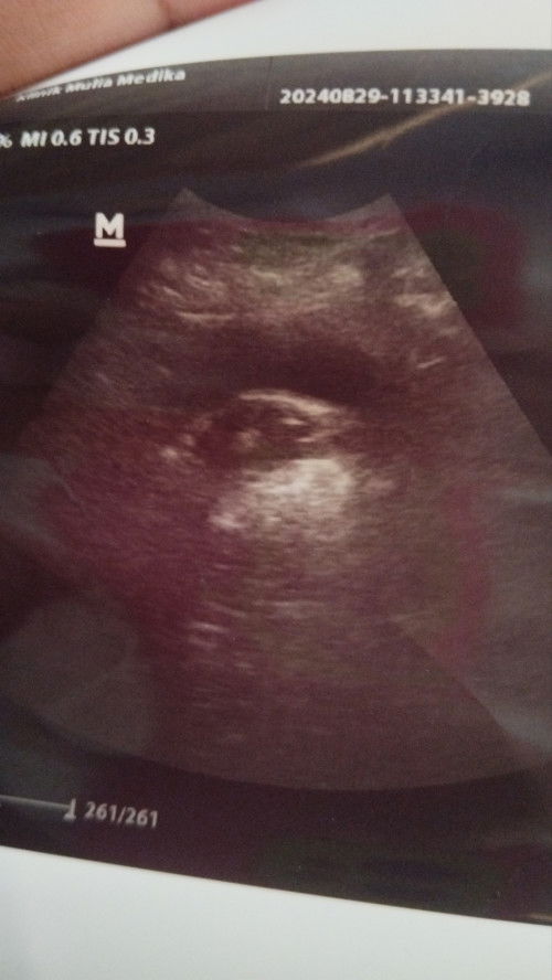 Bisa hilang sendiri ga ya?