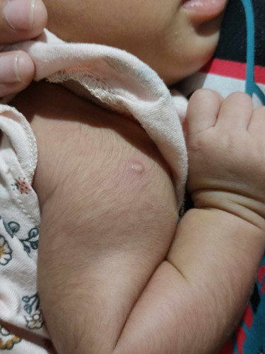 BCG Vaccine may nana