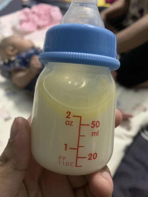 นมแม่เป็นสีเหลืองขึ้นแบบนี้น้องทานได้มั้ยแช่ช่องฟิตแค่คืนเดียวค่ะ