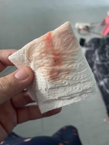 มีมูกเลือดแบบนี้