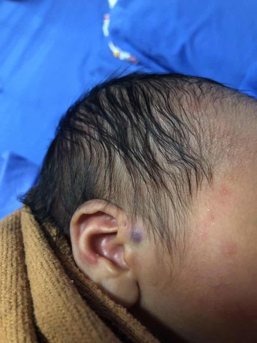 อยากถามแม่ๆหน่อยค่ะ