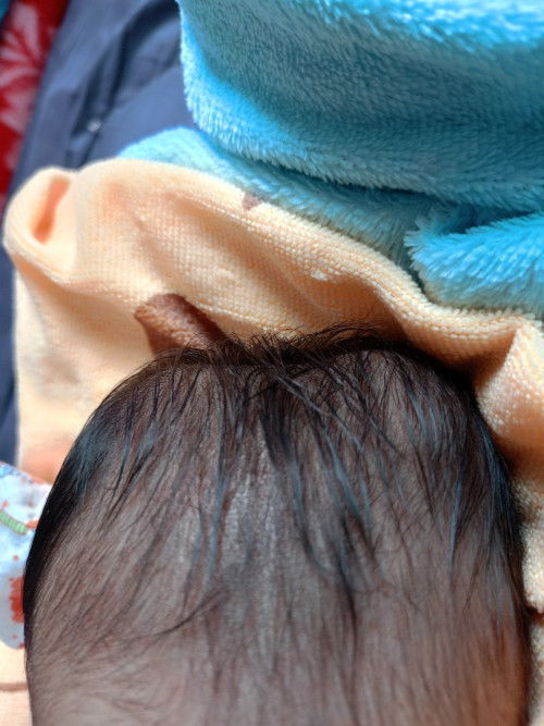 หัวน้องเป็นแบบนี้อันตรายไหมคะ มีบ้านไหนเคยเป็นแบบนี้บ้าง เป็นตั้งแต่เกิด คะ