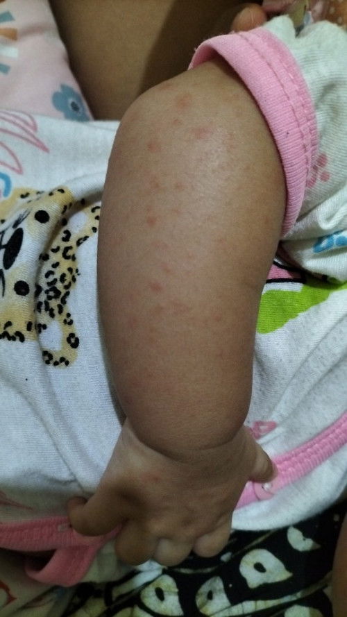 Keringat buntet Byi 3bln