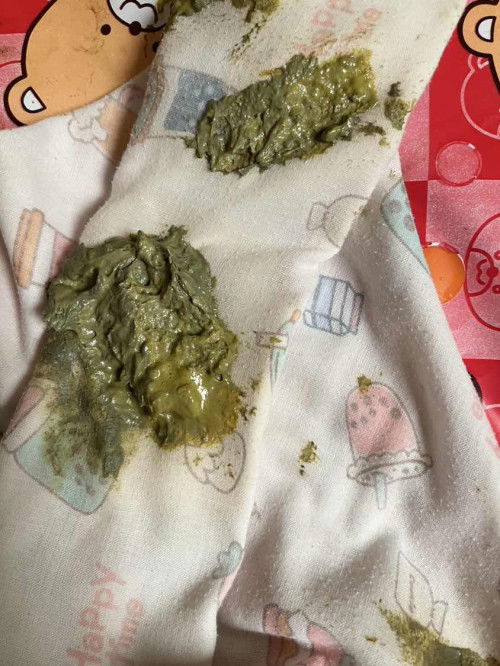 น้องกินนมผง+นมแม่ตอนแรกอึปกติหลังจากฉีดยามาวันแรกอึแบบในรูปไม่ปนเหลืองวันที่2มีปนเหลืองวันที่3แบบในรูปผิดปกไหมค่ะแม่ๆ