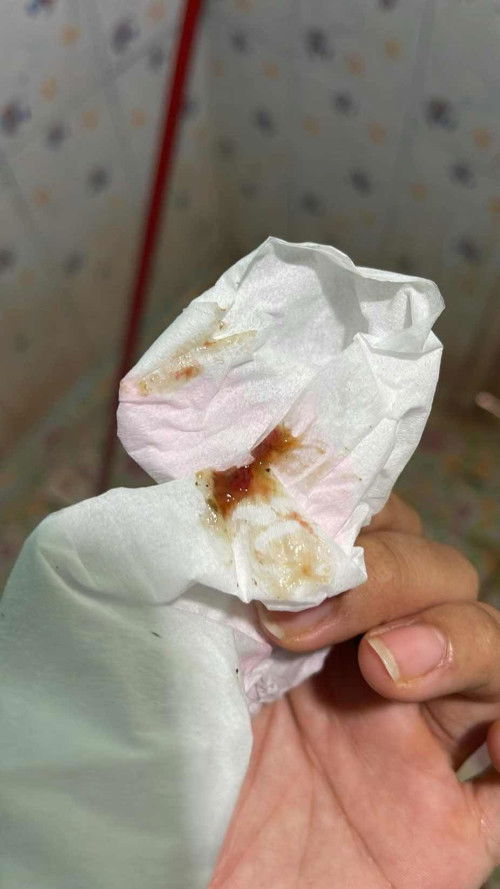 ตอนเช้าตอนท้อง เข้าห้องน้ำถ่ายมีมูกเลือด