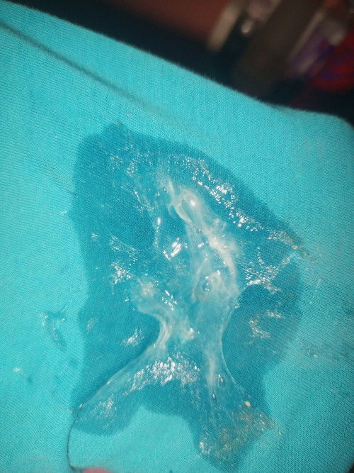 DISCHARGE!! Pasintabi sa iba ✌️