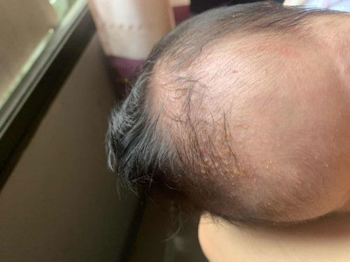 ลูกคนแรก 22 วัน