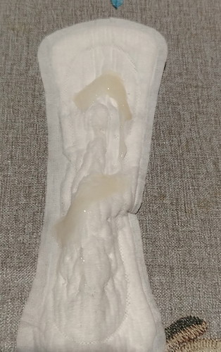 Mucus plug