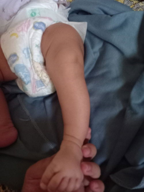 Tentang bentuk kaki bayi