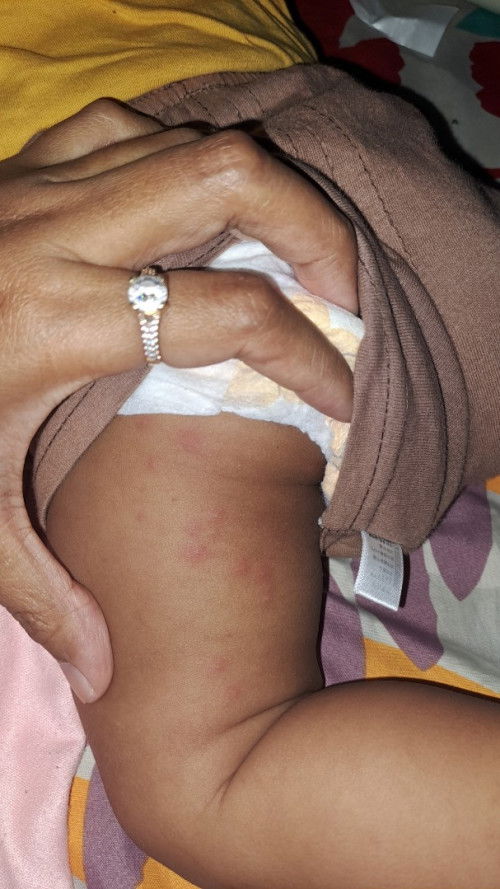 Mlenting apakah ini . Bantu jawab dong