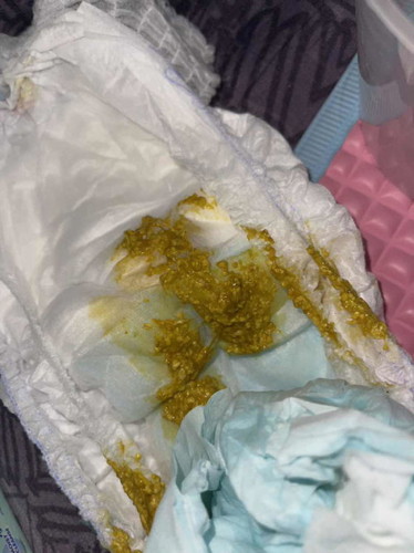 Najis macam ni normal ke ?