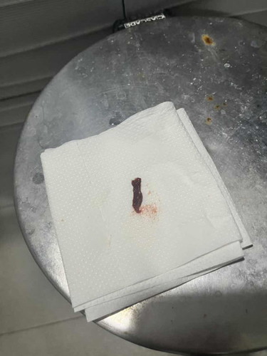Is this sign of miscarriage?