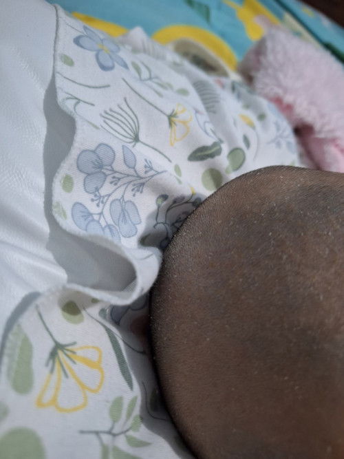 Kulit Kepala Bayi