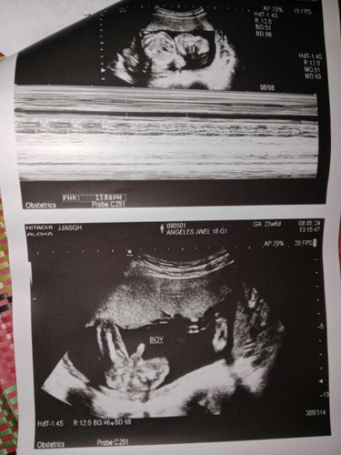 26weeks&5days