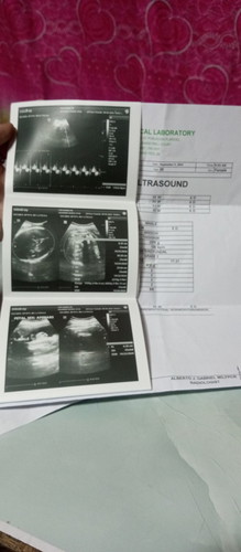Paano po ba pwede ko gawin para umaayos ng pwesto si baby 33weeks and 6days na po ako ngayon