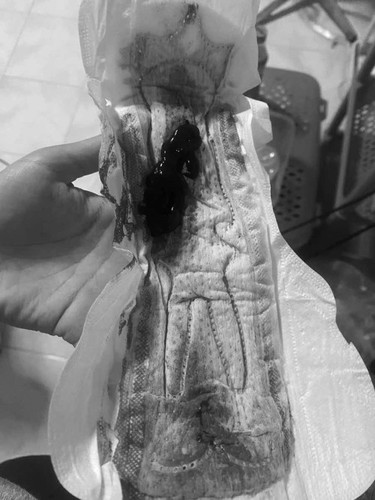 สอบถามทีค่ะ😰