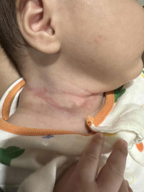 น้องคอแดงมาก