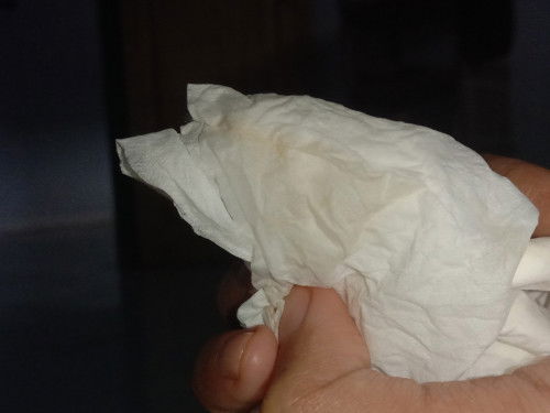 habis pipis tiba tiba keluar coklat