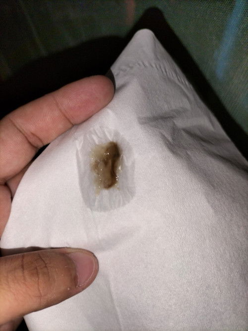 อยากสอบถามแม่ๆ