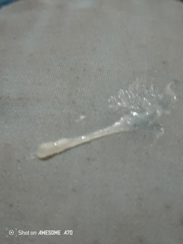 is this mucus plug?
