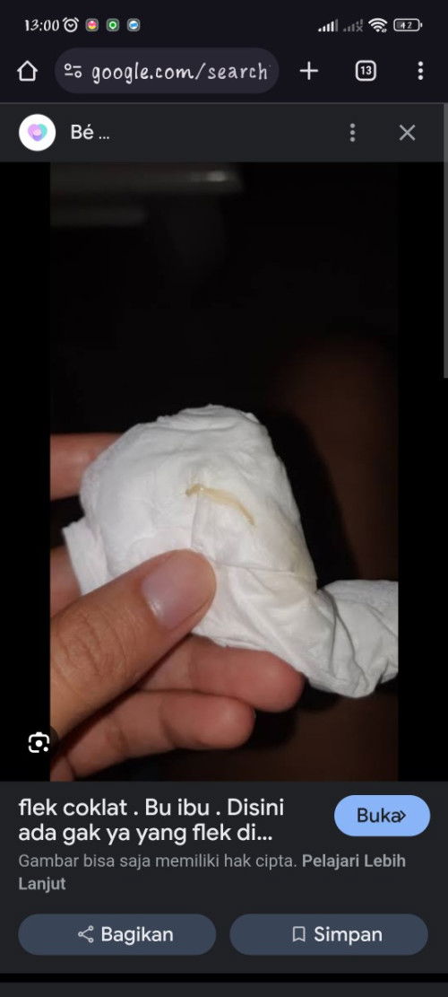 Termasuk keputihan atau flek