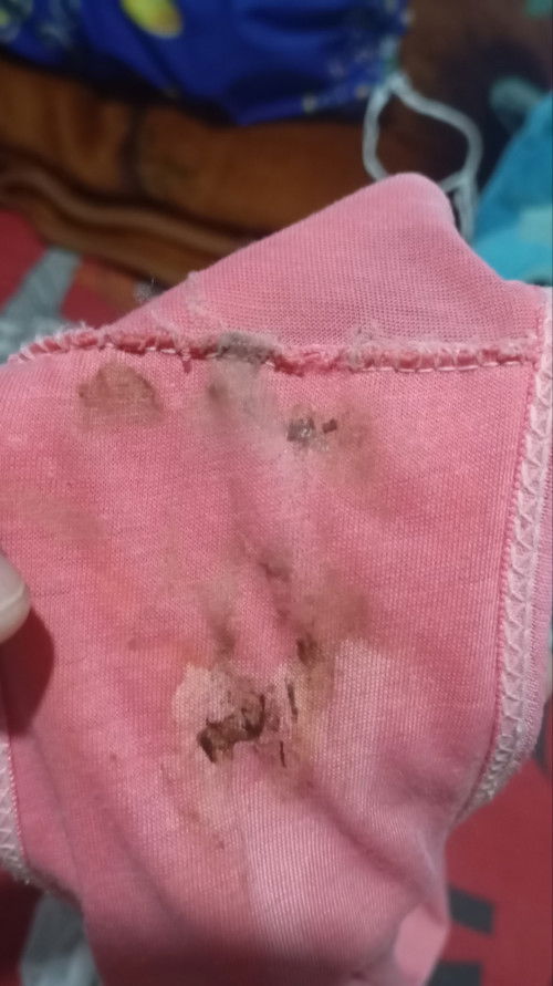 Flek coklat, HPL 17 September