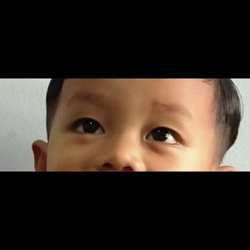 kantong mata anak ada benjolan/bengkak