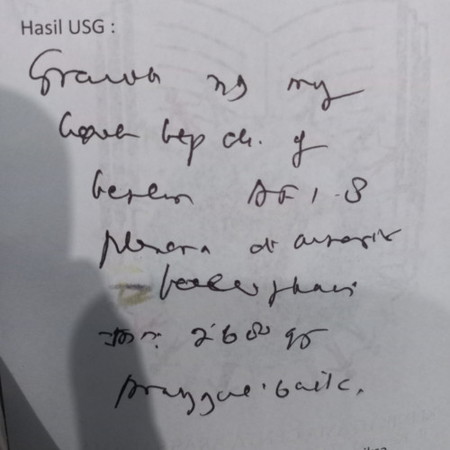 ARTI DARI USG