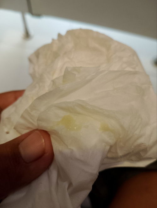 ใช้ตกขาวไม่#ท้องแรกค่ะ