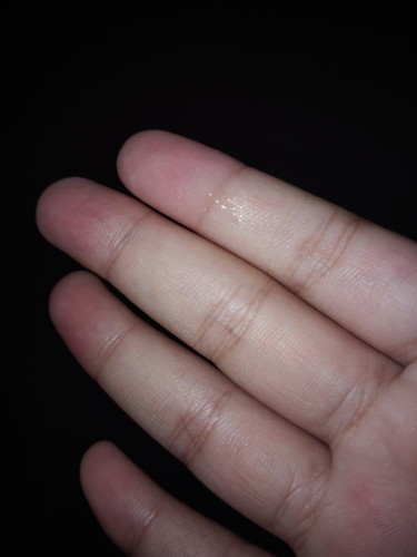 อยากถามแม่ๆค่ะว่าแบบนี้ควรไปโรงบาลมั้ย