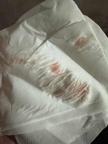 ปวดหน่วงท้องน้อยมีเลือดออก