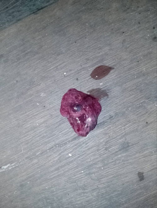 ini apa kantong baby ke