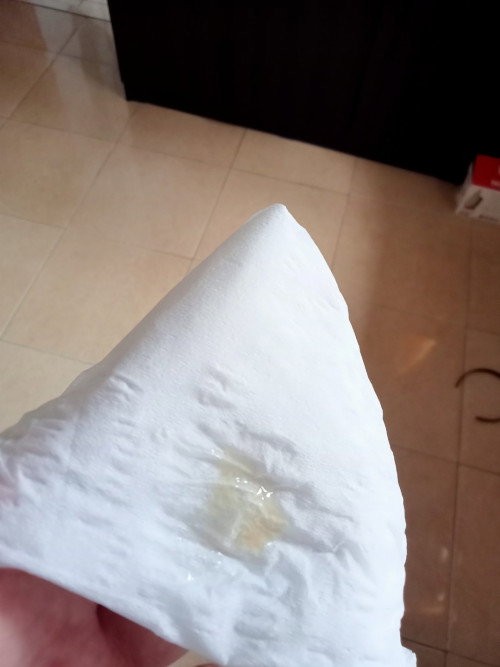Apakah pertanda mau melahirkan?