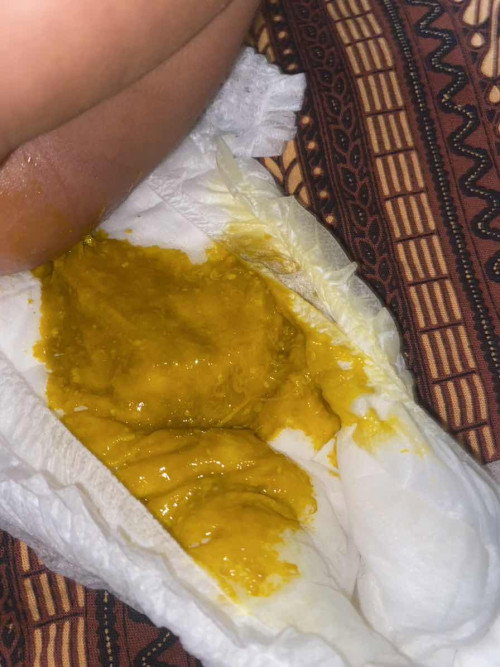 Bayi asi mencret