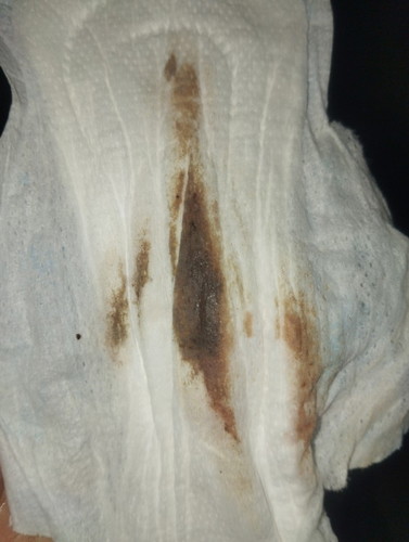 Implantation or Period?