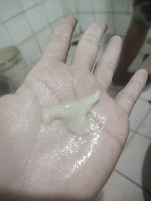 ต้องไปโรงบาลมั้ยค่ะ