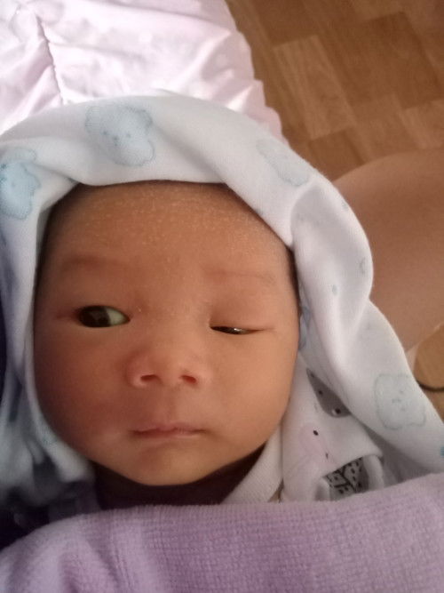 น้อง13วัน ลืมตาไม่เท่ากัน ปกติมั้ยคะ