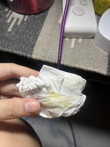 เป็นตกขาวแบบนี้อันตรายไหมคะ