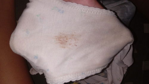 Ini apa? Worry liatnya