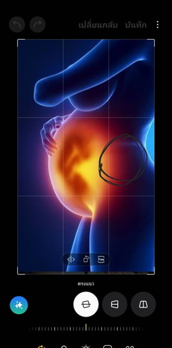 ปวดดดตรงเอวว